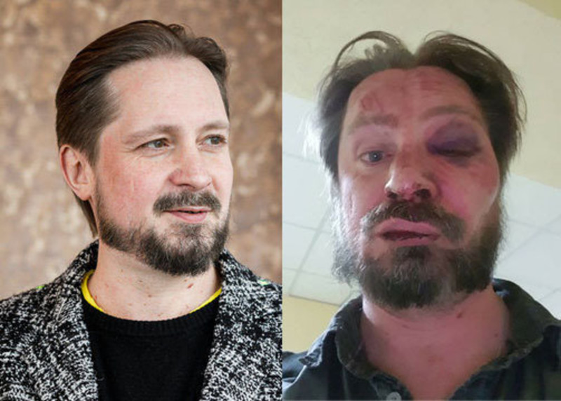 Сергей Чалый до и после нападения